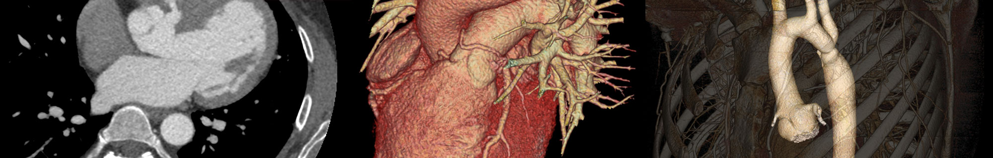 #Introducing the first ANZ  CT Coronary Angiography  Masters Series